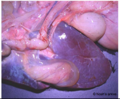 What material is covering the liver/gall bladder?