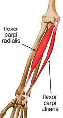 Origin: Medial epicondyle and posterior ulna
Insertion: Pisiform
Action: Flexes wrist
Innervation: Ulnar