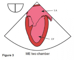 Angle: -80-100 degree 

Diagnostic uses:
- LA appendage - mass/ thrombus 
- LV apex
- LV systolic dysfunction 
- LV regional wall - anterior and inferior wall 
