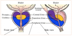 I den perifere sonen (80 %), som ligger baktil mot rectum og kaudalt mot uretra. 

Øvrige soner er den sentrale sonen (20 % av cancer) og transisjonssonen (BPH oppstår som regel her). 

