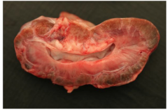 What type of inflammation is occurring in this dogs kidney? how can you tell?