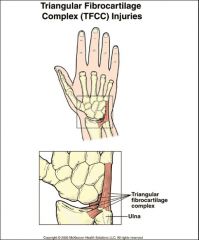 What are the 8 carpal bones in the wrist? What is the DRUJ? What is the TFCC?