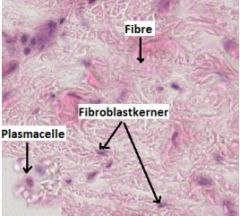 - Løst bindevæv fra colon (tyktarm)
- Fibroblastkerner og plasmaceller
Farvning: HE
