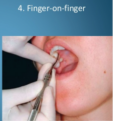 finger rest established on index finger or thumb of the non operating hand