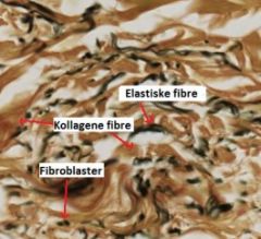 - Tæt, uregelmæssigt bindevæv fra hud


- Kollagene fibre, elastiske fibre, fibroblaster 


Farvning: Verhoeff