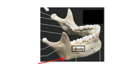 Name the part of the mandible. It connects the ramus to the body.