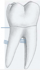 
-transseptal fibers: tooth to adjacent tooth
     *these are actually gingival fibers, NOT PDL
-oblique fibers: tooth (cementum) to alveolar bone
-inter-ridicular fibers: root to root