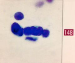 Be able to recognize a very fuzzy pic of some molded cells. (Resp)