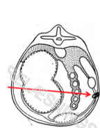 Omentet opsøges en håndsbredde caudalt for
pylorus
Omentopexi: Omentet sutureres til bugvæggen – 3
afbrudte knudesuturer
