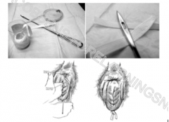 Her ser man den nål man bruger
og den tråd man bruger(minder om det man binder snørebånd med). 

Tegningen viser
vaginal-prolaps! 

 

Man tager nålen og fører den op
gennem vævet, tråder den og trækker tråden ud. Det gør man...