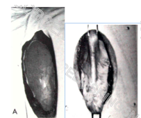 På disse
billeder vises hvordan vi først har bughulesåret hvor vommen er præsenteret i
såret. 
På næste
billede ser man hvordan vommen er grebet med nogle tænger.
