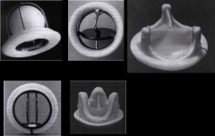 *Mechanical 
-Non-physiological biomaterials with caged balls, tilting discs, or hinged semicircular flaps

*Tissue (Bioprosthetic)
-Chemically-treated animal tissue mounted on a frame

Top left: ball and cage valve
top middle: disc valve
...
