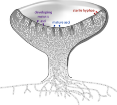 a closed spherical structure that develops a pore at the top for spore dispersal.