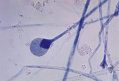 round structures that hold spores