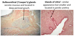 bulbourethral glands: located in deep perineal pouch, secrete mucous


glands of littre: similar in appearance but smaller and in penile urethra


pre-ejaculate-- lubrication