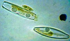 autotrophs protists
 Example: diatoms
