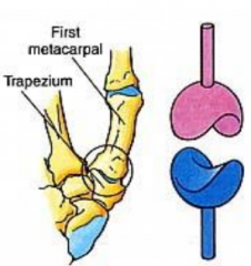 Type of synovial joint. Allows movements in several directions except rotation ex: carpometacarpal joint of thumb