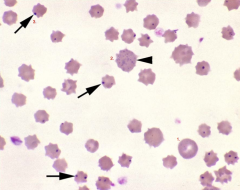 Identify the parasite/structures on this cow's blood film:
1.
2.
3.