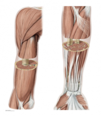 Function, innervation, and blood supply.
Muscles of the anterior arm are common flexors whereas posterior muscles are extensors.
