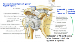 PLANAR joint, strengthened by trapezius muscle. Dislocation of AC joint occurs when the coracoclavicular ligament is ruptured.