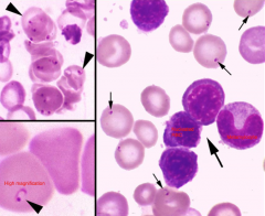 Identify the parasite/structure indicated by the small arrows/arrow-head in this blood film:
Small arrows/arrow-head: