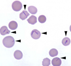 1. What other erythrocyte parasite mechanically causes IV hemolysis → hemolytic anemia  in ruminants (esp. in CATTLE)?
2. What stage of this organism is within RBCs?