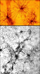 The "medusa-like" glial cells depicted here are called what?