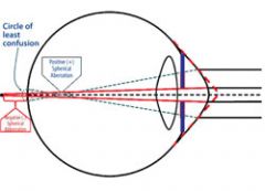 at the midpoint between the two focus lines (in an astigmatism) a circle is formed, the circle of least confusion