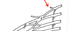 What is the nerve of the brachial plexus highlighted in the image?