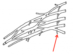 Long thoracic nerve (C5-7)
