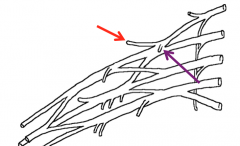 The suprascapular nerve (red) and the subclavian nerve (purple)