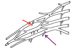 Lateral pectoral nerve (red)
Medial pectoral nerve (purple)