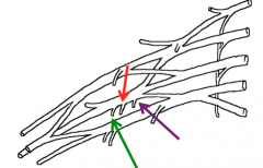 The branches of the posterior cord of the brachial plexus
Green-Lower Subscapular nerve
Red-Thoracodorsal nerve
Purple-Upper Subscapular nerve