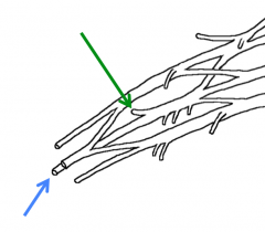 The terminal branches of the posterior cord
Green-Axillary nerve
Blue-Radial nerve