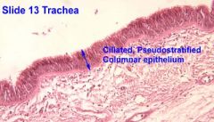  - Pseudostratified Ciliated Columnar Epithelium  
(as seen on slide of Larynx) 
250X

Function:  secretion, particularly of 
mucus 
- propulsion of mucus by ciliary action


