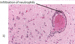 - macrophages
- neutrophils