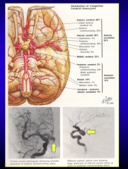 Anterior cerebral or internal carotid