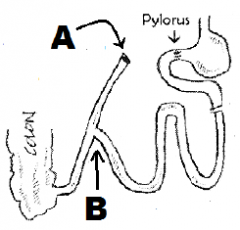 Which end is the “roux” end in a Roux en-Y gastric bypass surgery?

The "Y" end?