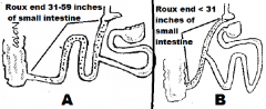 Roux en-Y proximal gastric bypass?
Roux en-Y distal gastric bypass?