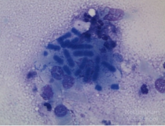 The following cytology is from a bronchoalveolar lavage in a dog.

Which one of the following choices is the most likely diagnosis?

A - Fungal bronchopneumonia
B - Bacterial contamination
C - Eosinophilic pneumonitis
D - Bacterial bronchopneumonia