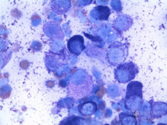 A five-year-old Boxer dog presents for routine vaccinations. The owner points out a small, smooth mass on the right ear.

Fine needle aspiration cytology is shown below. Which one of the following choices is the most likely diagnosis? 

A - Pyogranulo