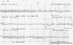 A twelve-year-old female spayed miniature schnauzer presents with a history of seizure-like episodes.

Physical exam reveals an irregular heart beat. CBC and panel are unremarkable except for a mild triglyceridemia. ECG is shown below.

Which one of t