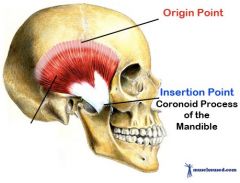 *Elevates and retracts the mandible 



Origin: temporal bone 
Insertion: mandible bone (coranoid process)