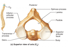 Dens or Odontoid: holds C1 in place