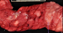 what is this gross pathology most consistent with? is it normal, malignant, or benign? what species is this seen in?
