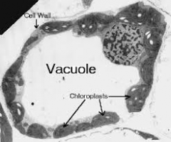 Célula  eucariota
CELULAS VEGETALES