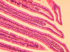 Simple Columnar Epithelium of Small Intestine 

Function: 
- where most of 
digestion and 
absorption of food takes place 

 - receives bile juice and pancreatic juice
