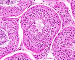 TESTES

Function: gland where sperm and testosterone and produced