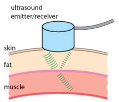 The ultrasound machine in the figure receives echoes from the top of the layer of muscle 6.5 × 10^–6 seconds after the pulse is emitted. 


Assume the speed of sound in muscle tissue is 1600 m/s. 


Some of the ultrasound waves emittedby the ma...
