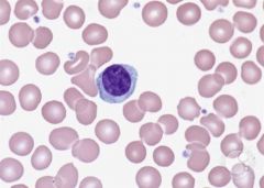A type of white blood cell that produces antigens to fight off bacteria. Eg. The lymphocyte produced antigens to destroy the bacteria to prevent widespread of it through the body, generating disease.